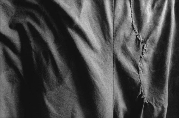 Stitches